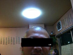 太陽拳